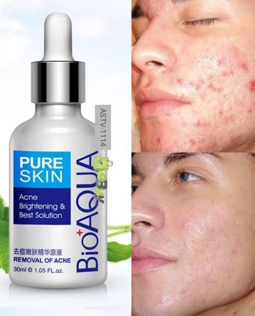 BioAqua Pure Skin Acne Serum